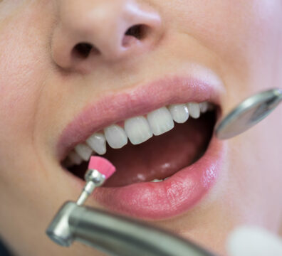 Dentist examining a female patient with tools at dental clinic